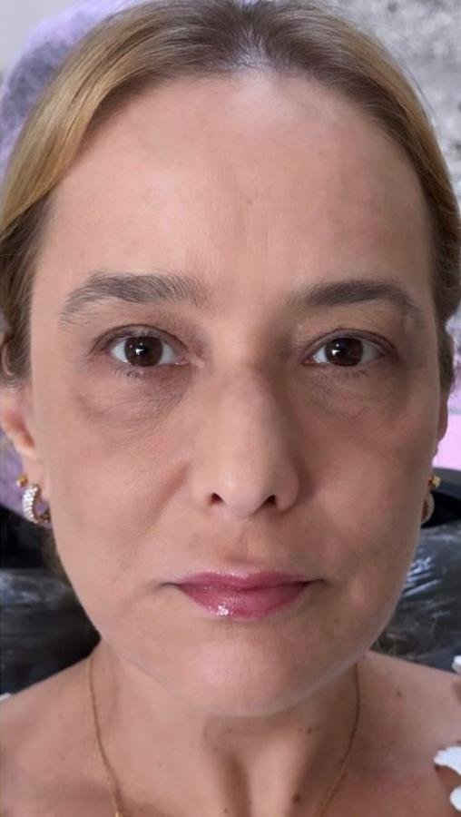Imagem depois, do caso apresentado