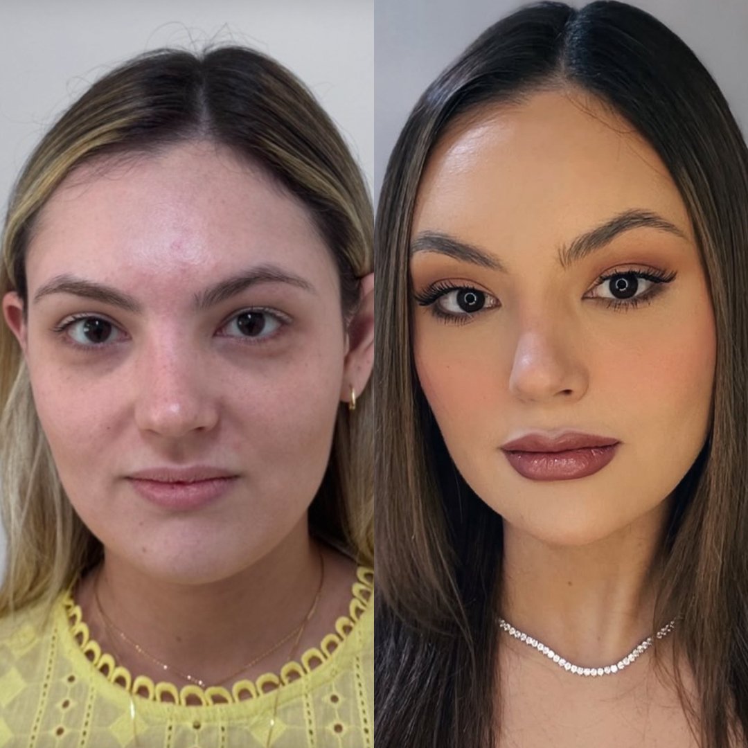 Comparativo lado a lado da paciente mais jovem loira